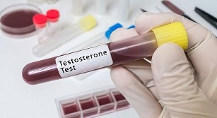 hormonlar için sigara içmek ve kan bağışı yapmak